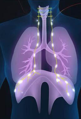 使用體外膈肌起搏器(EDP)可實現(xiàn)“五增一降”的功能